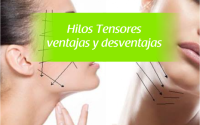 Hilos Tensores Ventajas y Desventajas